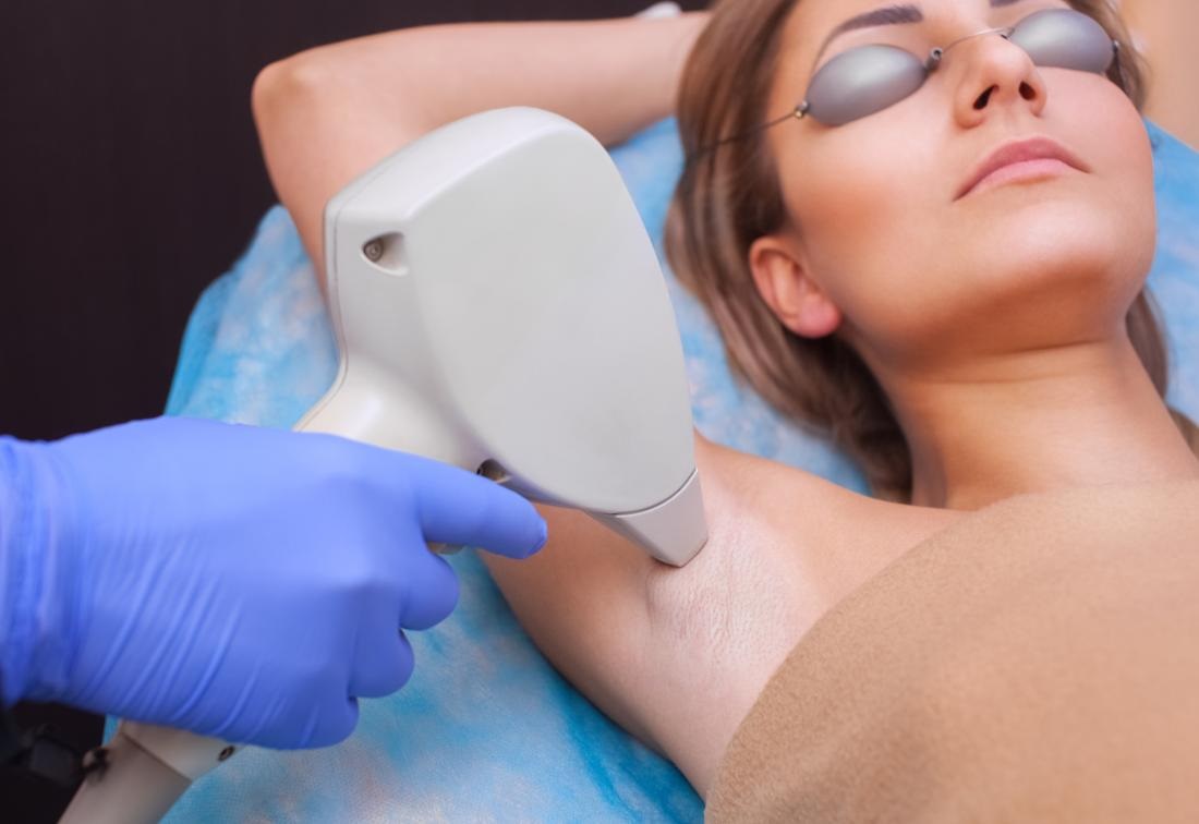 How Does Laser Hair Removal Work