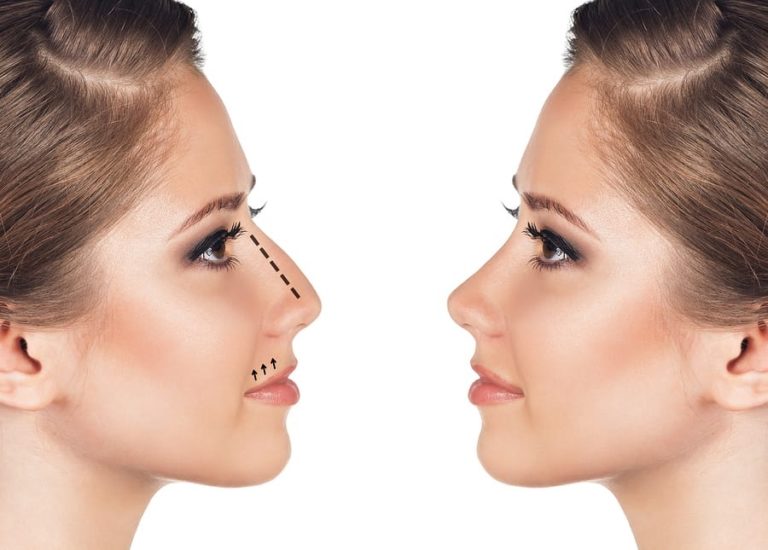 Important Traits To Look For When Choosing A Nose Surgery Clinic