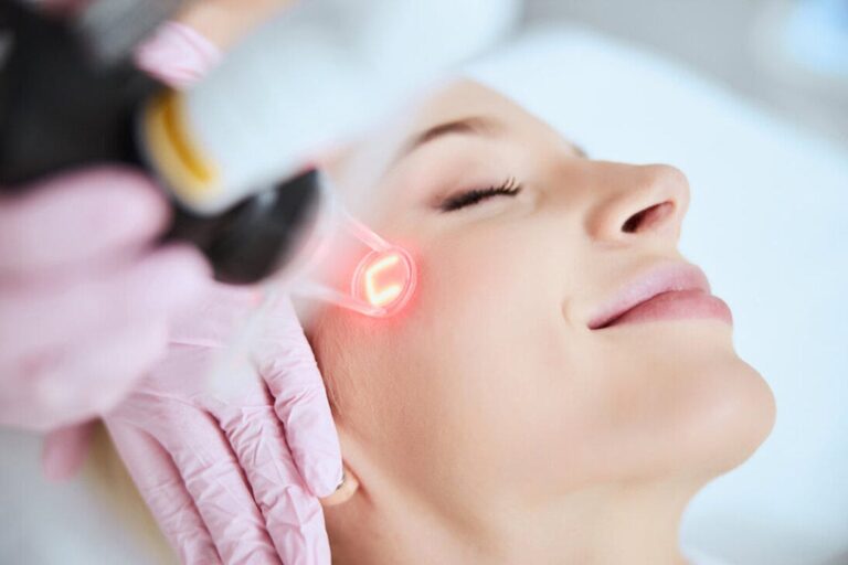 Exploring the Costs of Pico Laser Treatments What to Expect