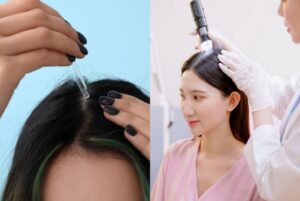 hair growth treatments in Singapore