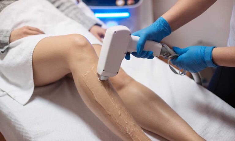 Laser Hair Removal